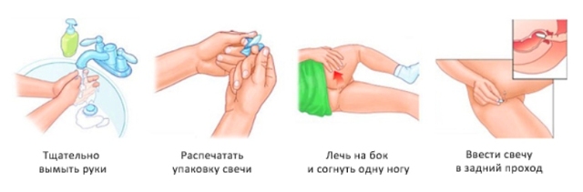 Глицериновые свечи после родов со швами. Применение глицериновых свеч после родов