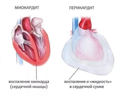 Почему сердце колит и что можно сделать в домашних условиях?