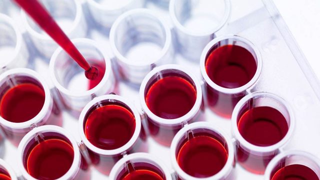 Мочевая кислота составляет уменя 755 что делать. Какая норма мочевой кислоты в крови мужчин, женщин и детей