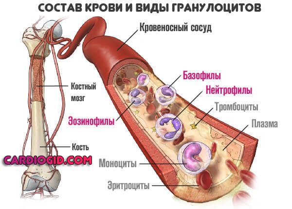 Нейтропения и ее причины. Лекарственная нейтропения