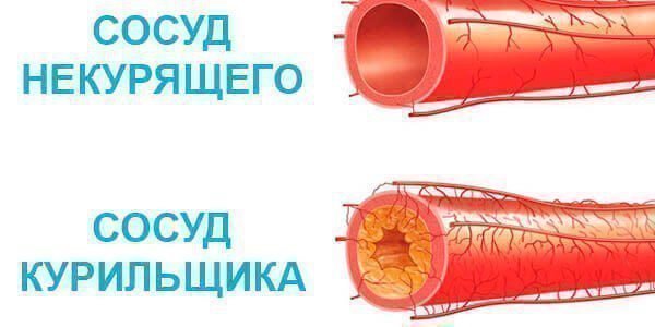 Как курение влияет на сердце человека: тахикардия, пульс, мерцательная аритмия