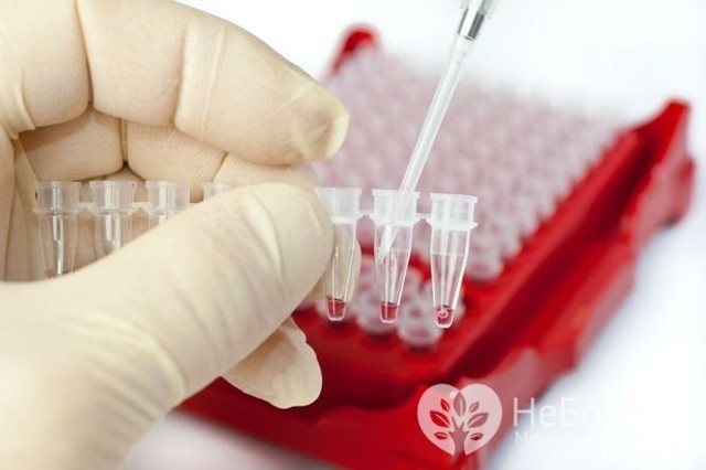 Общий (развернутый) анализ крови: что показывает, как сдавать