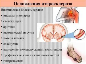 Какой врач лечит сосуды головного мозга, атеросклероз?