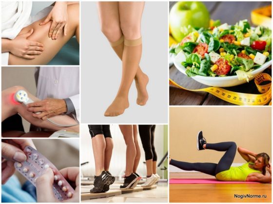 Послеоперационный период при операции на венах ног