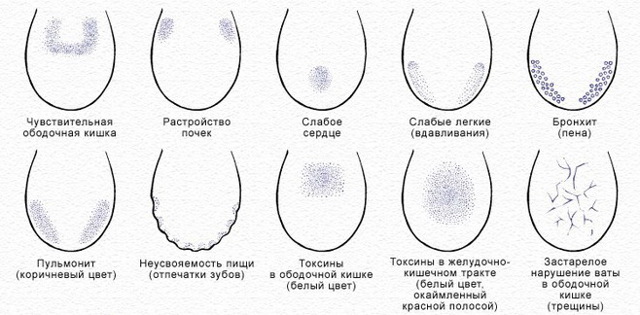 Трещины на языке посередине и белый налет: причины и лечение