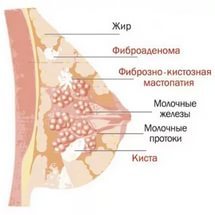 Болит грудь сбоку: причины и симптомы