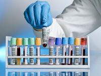 Билиарная гипертензия печени: симптомы, признаки на УЗИ и лечение синдрома