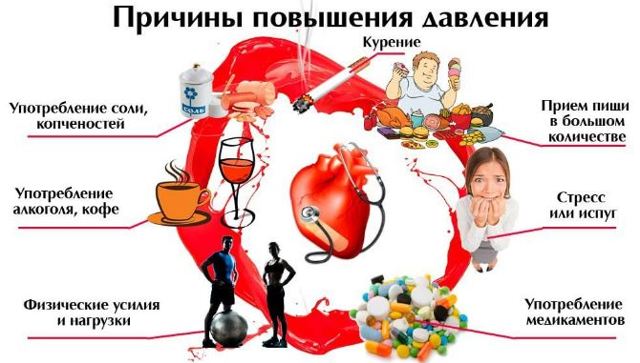 Высокое давление – причины, признаки, симптомы. Что делать при повышенном давлении?