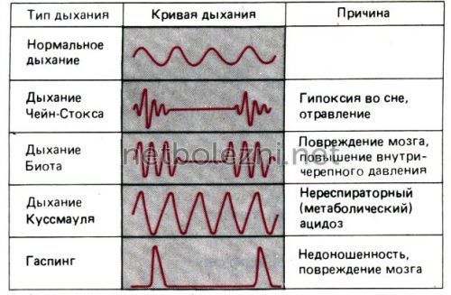 Тяжело дышать не хватает воздуха что делать