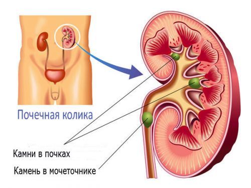 Боли в правом боку живота у женщин - причины и методы лечения