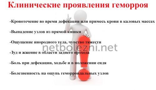 Свечи от геморроя - недорогие и эффективные свечи от геморроя при шишках