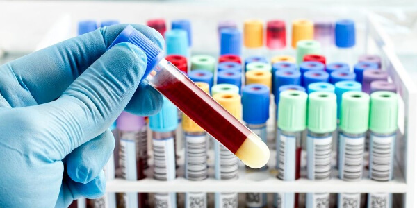 Анти-HCV положительный: что это значит, расшифровка
