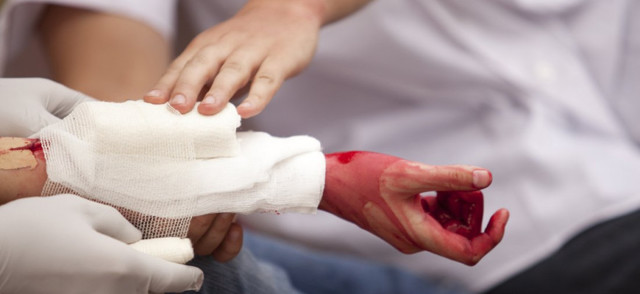 Виды кровотечений и оказание первой помощи
