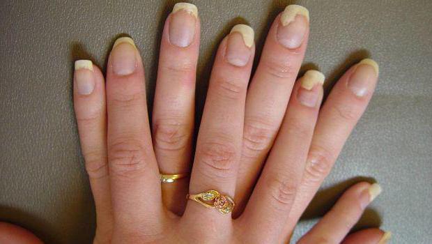 БИФОСИН - инструкция по применению, противопоказания, отзывы