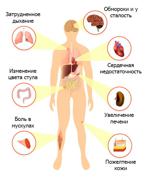 Низкий гемоглобин - причины, симптомы и лечение Низкого или пониженного гемоглобина