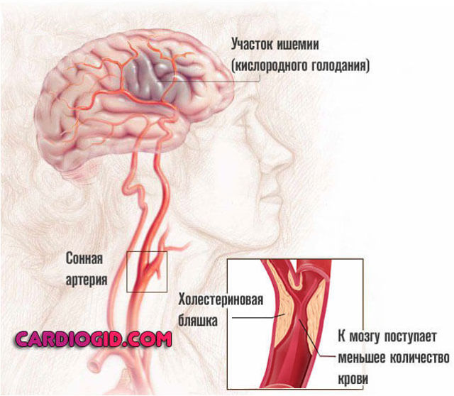 Как и чем повысить верхнее систолическое давление в домашних условиях? Низкое верхнее артериальное давление: причины и лечение