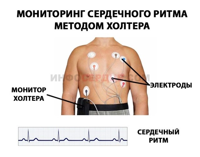 Позиция сердца вертикальная: как выглядит, признаки заболевания, расшифровка, что это