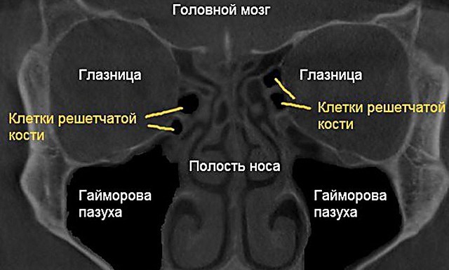 Клиническая анатомия носа. Кровоснабжение полости носа