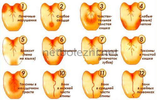 Черный налет на языке — начало больших проблем