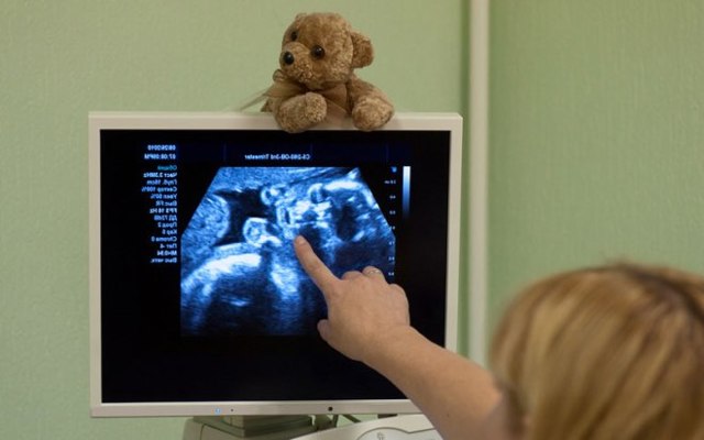 Расшифровка УЗИ сердца у детей: нормы по возрастам