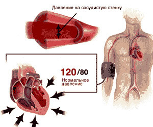 Сосуды головного мозга: симптомы, диагностика, лечение