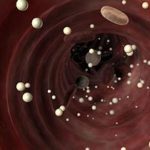 Пониженный сахар в крови симптомы у женщин: признаки и причины