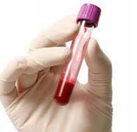 АЛТ в крови – что показывает АЛТ в крови? Норма, что делать, если повышен АЛТ?