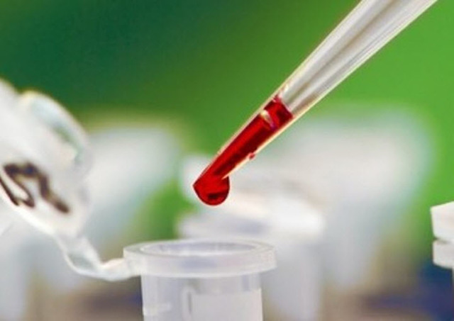 Анализ крови при лейкозе. Какие изменения в крови вызывает лейкоз. Биохимический анализ крови.