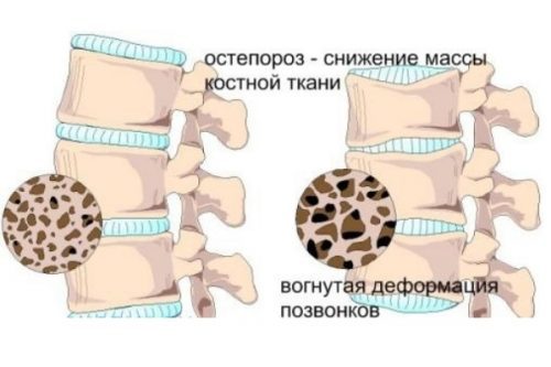 Фороза цена в Томске от 549 руб., купить Фороза, отзывы и инструкция по применению