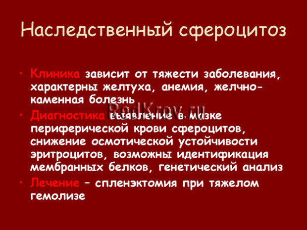 Болезнь Минковского-Шоффара: симптомы, причины возникновения, лечение