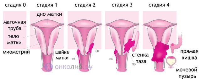 Кровянистые выделения после полового акта: причины, что означает, лечение