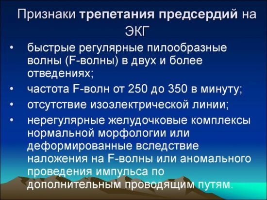 Трепетание предсердий на ЭКГ, причины трепетания желудочков