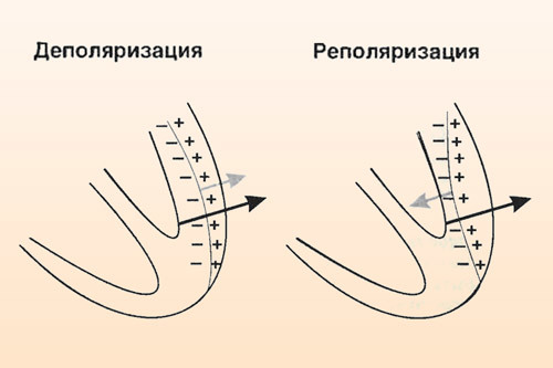 Изменение миокарда левого желудочка: что это такое, диффузный и неспецифический вид