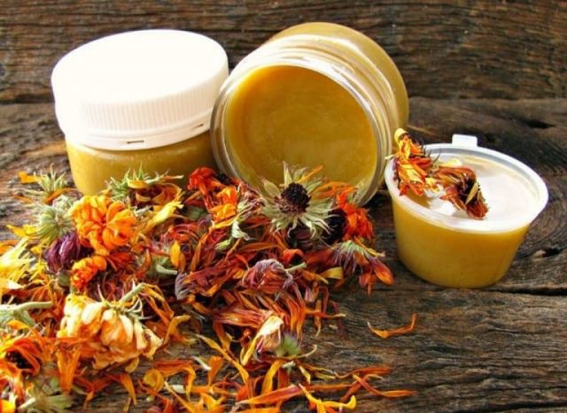 Народные способы лечения геморроя