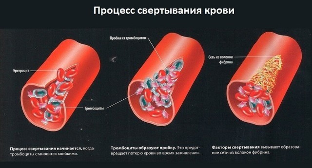 Болезнь крови. Болезни органов крови