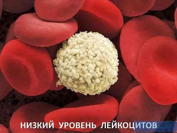 Лейкопения: этиология, симптомы и методы лечения