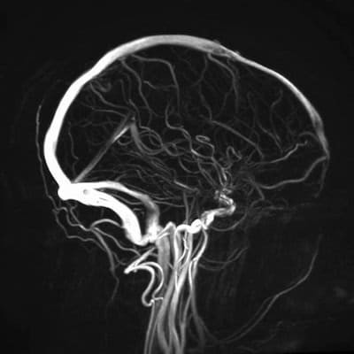 Сделать мр-венография головного мозга в Санкт-Петербурге - ICLINIC
