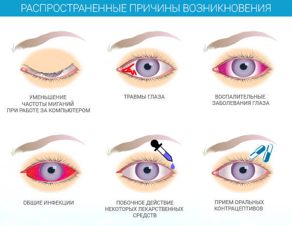 Капли для сосудов глаз: сосудорасширяющие препараты и лекарства для укрепления и лечения
