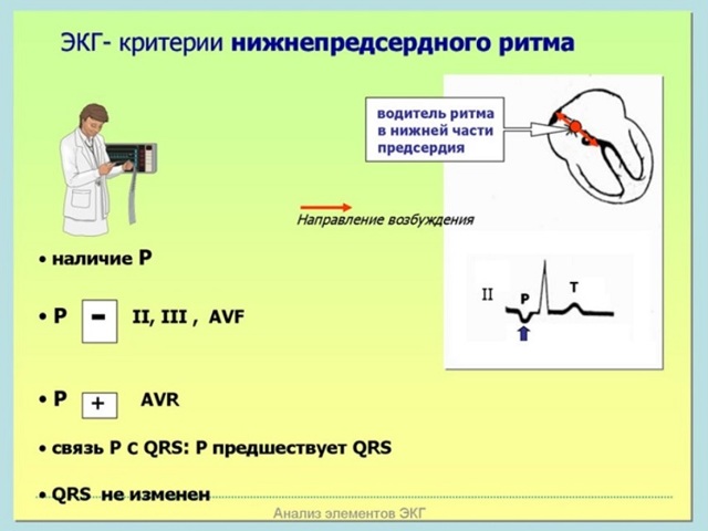Предсердный ритм норма или патология?