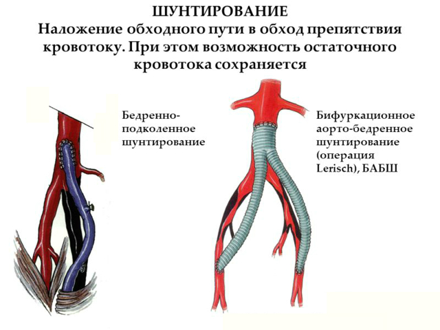 Как почистить сосуды: самые эффективные методы.