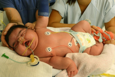 Сахар в крови у ребенка понижен - Лечение диабета