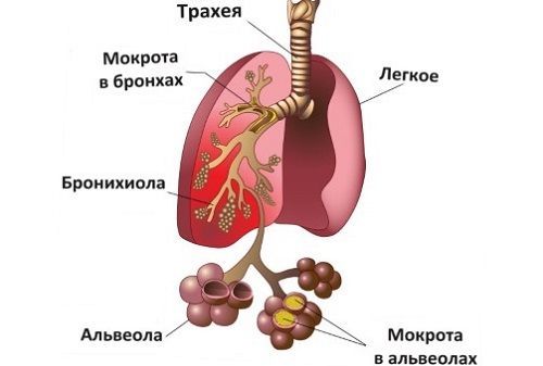 Как лечить кашель при беременности — что можно и нельзя?