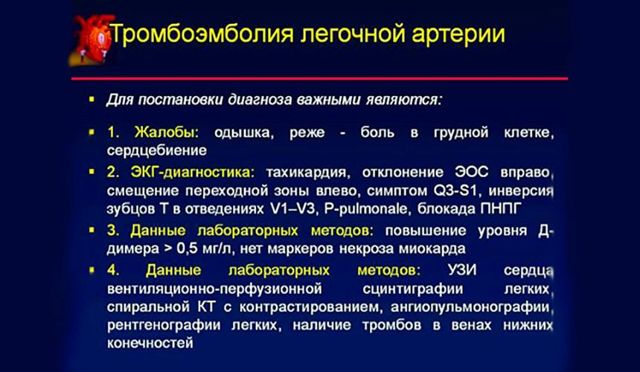 Тромбоэмболия - что это такое: признаки, диагностика и профилактика