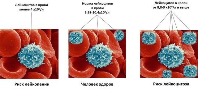 Норма лейкоцитов в крови у женщин: особенности и причины отклонений