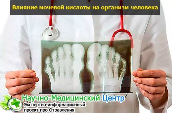 Мочевая кислота составляет уменя 755 что делать. Какая норма мочевой кислоты в крови мужчин, женщин и детей