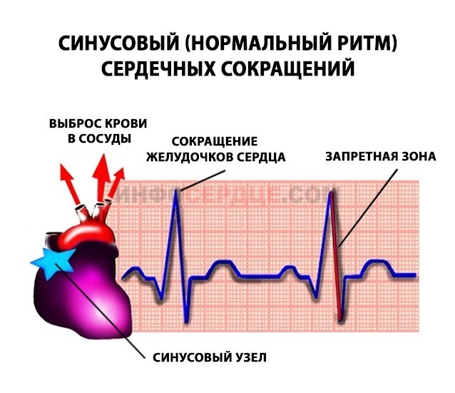 Синусовый ритм сердца: что это, ЭКГ, нарушения ритма