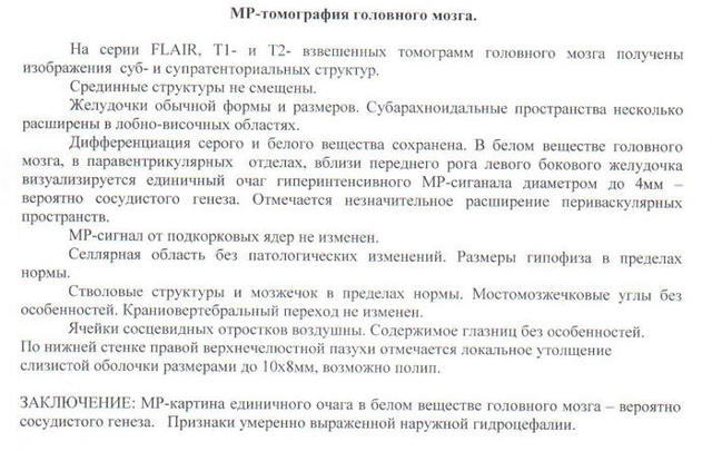 Очаговые изменения белого вещества головного мозга что это такое?