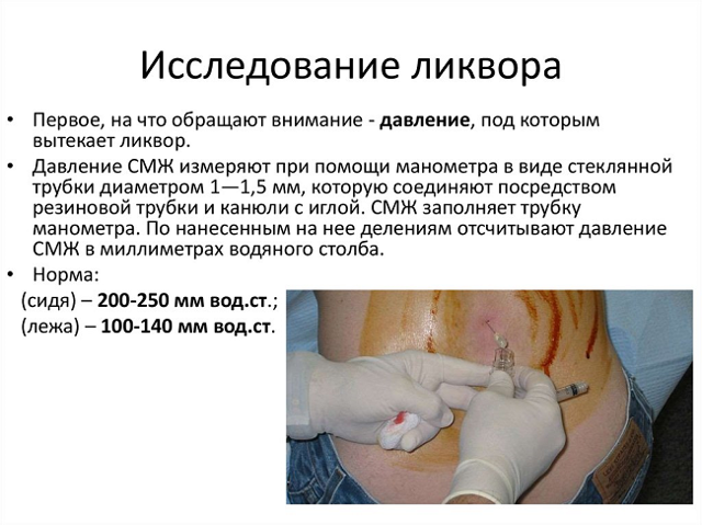 Симптомы и лечение повышенного внутричерепного давления