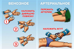 Последствия потери крови.