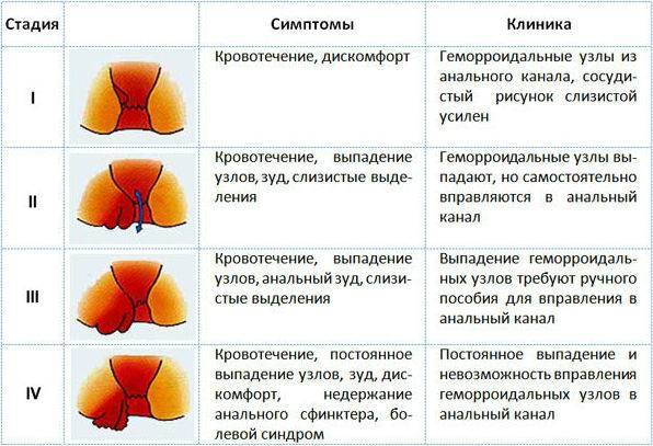 Роды с геморроем - можно ли? и как рожать с геморроем, наши советы